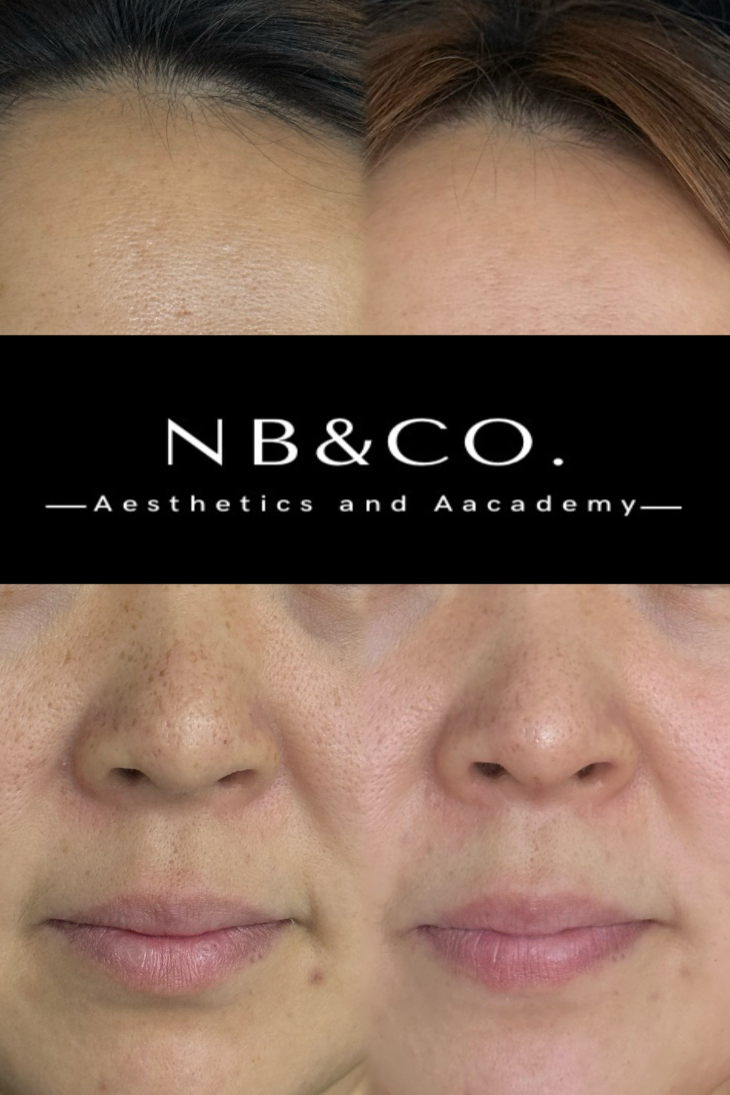 Lumecca real before and after spot fading and brightening result